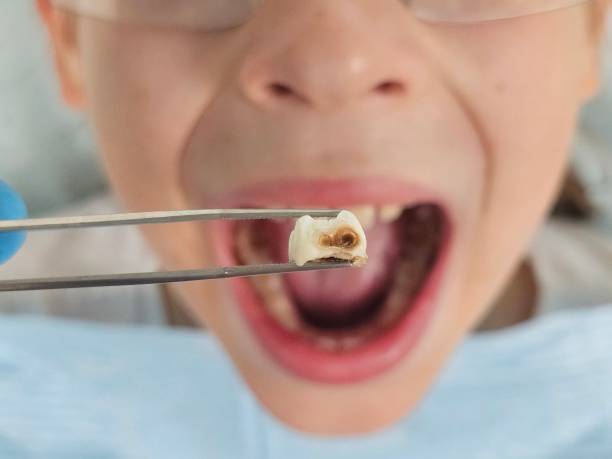 Best Emergency Dental Surgery in Myrtle Point, OR